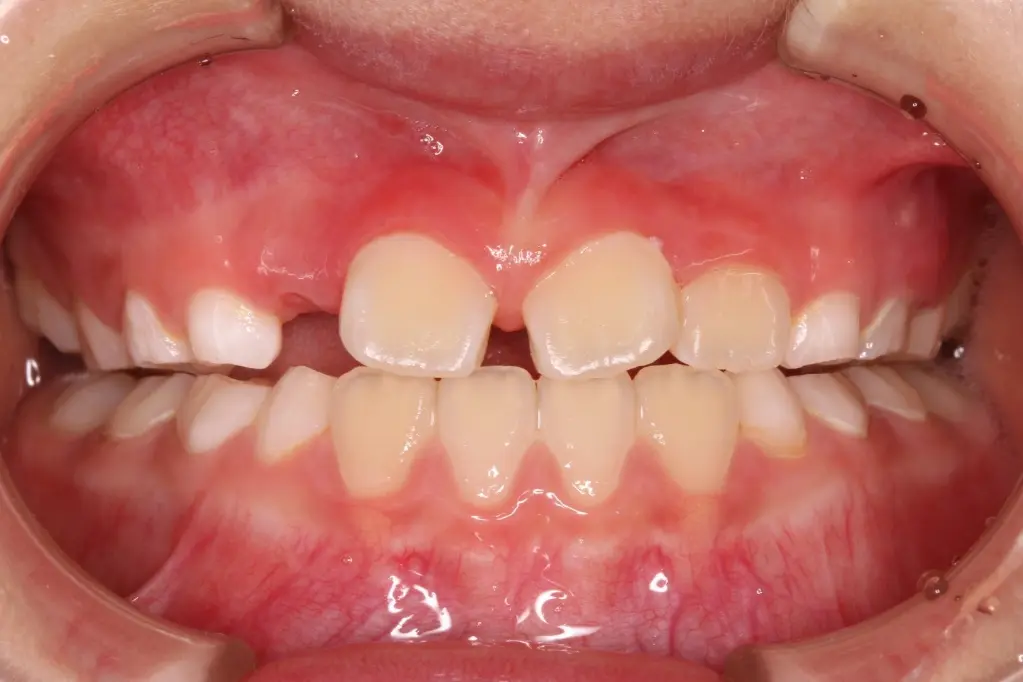 治療8ヶ月後の状態